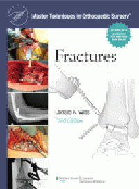Fractures, 3rd ed.(Master Techniques in Orthopaedic Surgery)