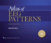Atlas of EEG Patterns, 2nd ed.