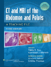 CT & MRI of the Abdomen & Pelvis, 3rd ed.- A Teaching File