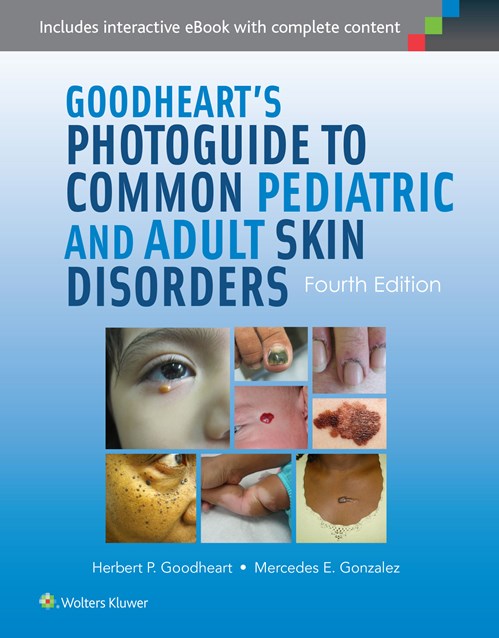 Goodheart's Photoguide to Common Pediatric & Adult SkinDisorders, 4th ed.