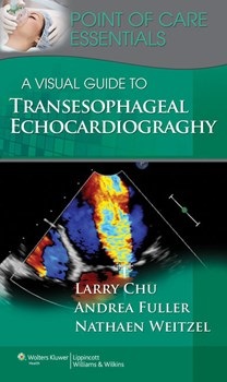 Visual Guide to Transesophageal Echocardiography