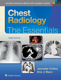 Chest Radiology, 3rd ed.- Essentials