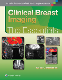 Clinical Breast Imaging- Essentials
