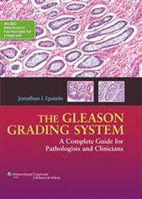 Gleason Grading System- A Complete Guide for Pathologist and Clinicians