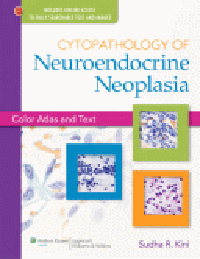Cytopathology of Neuroendocrine Neoplasia- Color Atlas & Text