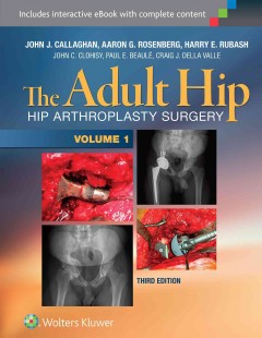 Adult Hip, 3rd ed., in 2 vols.- Hip Arthroplasty Surgery