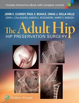 Adult Hip- Hip Preservation Surgery