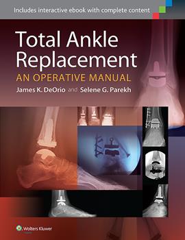 Total Ankle Replacement- An Operative Manual