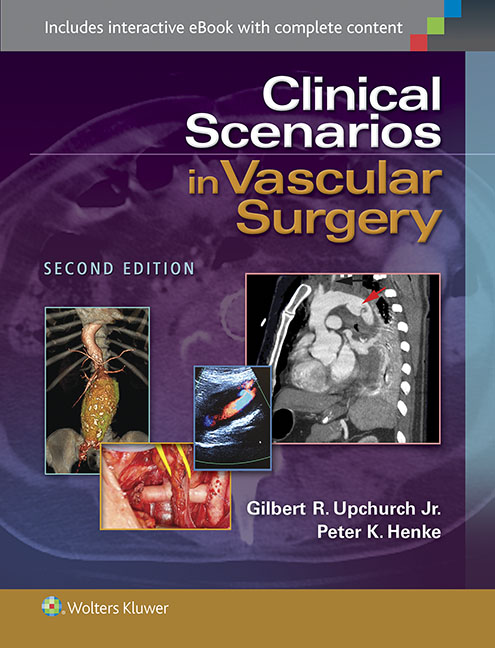 Clinical Scenarios in Vascular Surgery, 2nd ed.