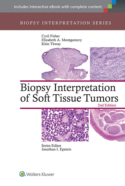 Biopsy Interpretation of Soft Tissue Tumors, 2nd ed.