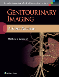 Genitourinary Imaging- A Core Review