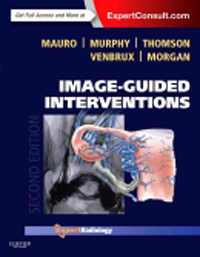 Image-Guided Intervention, 2nd ed.(Expert Radiology Series)(With Online Access)