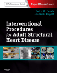 Interventional Procedures for Adult Structural HeartDisease