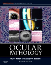 Ocular Pathology, 7th ed.