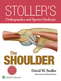 Stoller's Orthopaedics & Sports Medicine: Shoulder& E-Book