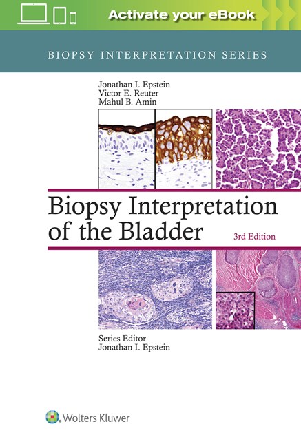 Biopsy Interpretation of the Bladder, 3rd ed.(Biopsy Interpretation Series)