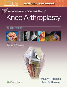 Master Techniques in Orthopedic Surgery, 4th ed.- Knee Arthroplasty
