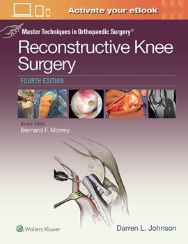 Reconstructive Knee Surgery, 4th ed.(Master Techniques in Orthopaedic Surgery Series)