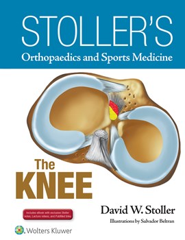 Stoller's Orthopaedics & Sports Medicine- The Knee Package (Print Edition Packaged with StollerLecture Videos & Stoller Notes)