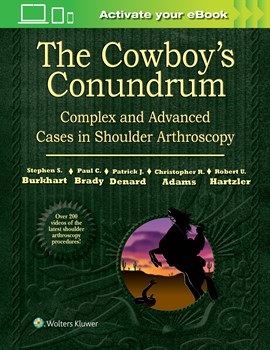 Cowboy's Conundrum- Complex & Advanced Cases in Shoulder Arthroscopy