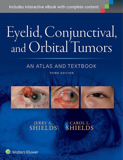 Eyelid, Conjunctival & Orbital Tumors, 3rd ed.- An Atlas & Textbook
