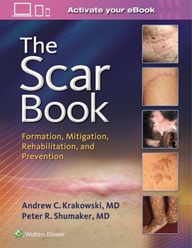 Scar Book- Formation, Mitigation, Rehabilitation & Prevention