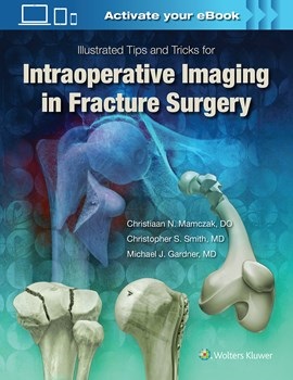 Illustrated Tips & Tricks for Intraoperative Imaging inFracture Surgery