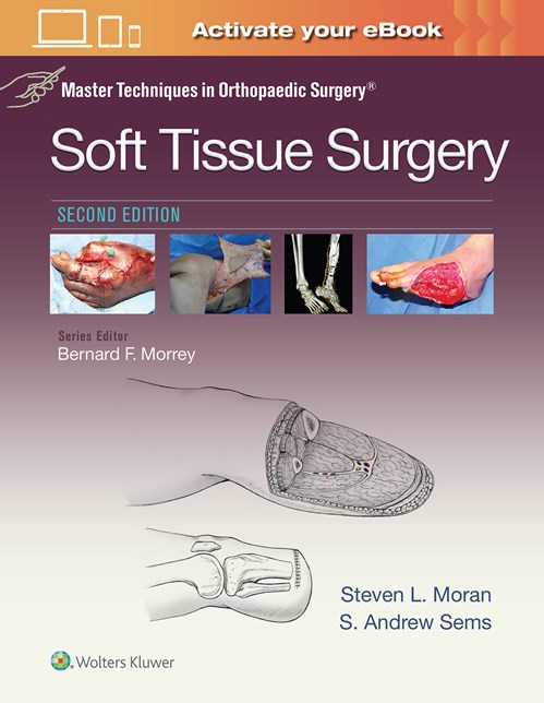 Soft Tissue Surgery, 2nd ed.(Master Techniques inOrthopaedic Surgery)