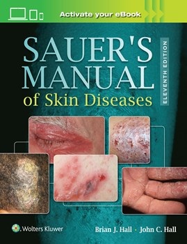 Sauer's Manual of Skin Diseases, 11th ed.