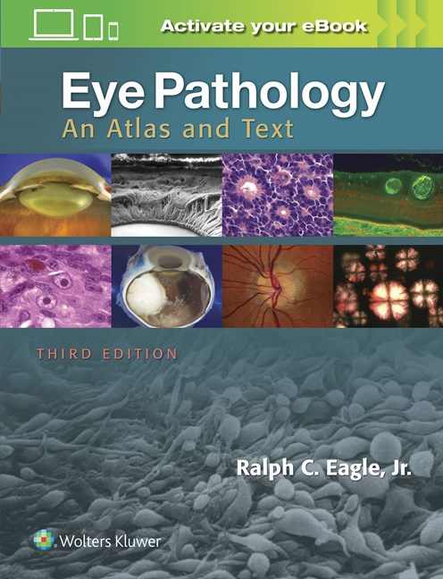 Eye Pathology, 3rd ed.- Atlas & Text