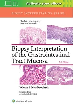 Biopsy Interpretation of the Gastrointestinal TractMucosa, 3rd ed.Vol.1: Non-Neoplastic