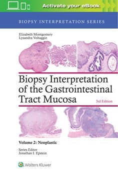 Biopsy Interpretation of the Gastrointestinal TractMucosa, 3rd ed.Vol.2: Neoplastic