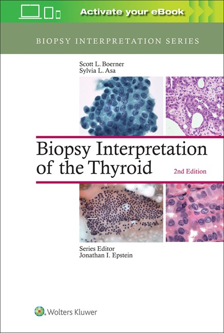 Biopsy Interpretation of Thyroid, 2nd ed.