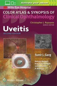 Color Atlas & Synopsis of Clinical Ophthalmology- Uveitis, 2nd ed.