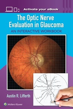 Optic Nerve Evaluation in Glaucoma- An Interactive Workbook