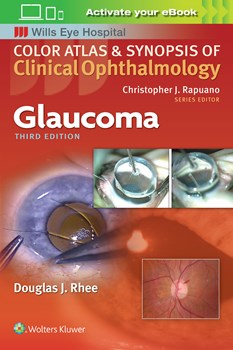 Color Atlas & Synopsis of Clinical Ophthalmology- Glaucoma, 3rd ed.