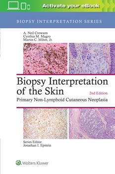 Biopsy Interpretation of the Skin, 2nd ed.(Biopsy Interpretation Series)- Primary Non-Lymphoid Cutaneous Neoplasia