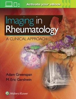 Imaging in Rheumatology- A Clinical Approach