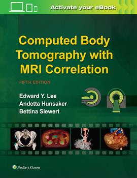 Computed Body Tomography with MRI Correlation, 5th ed.