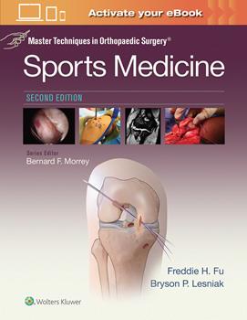 Sports Medicine, 2nd ed.(Master Techniques in Orthopaedic Surgery Series)