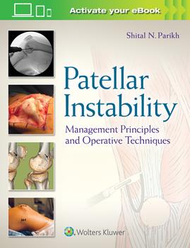 Patellar Instability- Management Principles and Operative Techniques