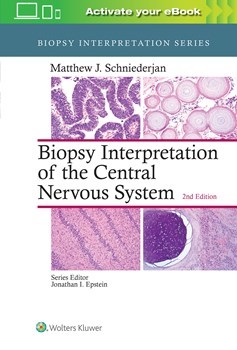 Biopsy Interpretation of the Central Nervous System,2nd ed.(Biopsy Interpretation Series)