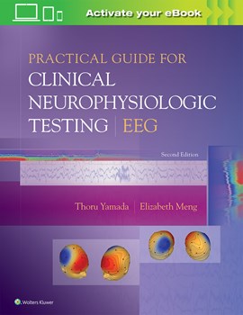 Practical Guide for Clinical Neurophysiologic Testing: EEG, 2nd ed.