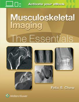 Musculoskeletal Imaging- The Essentials