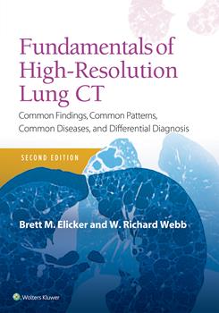 Fundamentals of High-Resolution Lung CT, 2nd ed.- Common Findings, Common Patterns, Common Diseases, &Differential Diagnosis