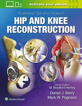 Illustrated Tips & Tricks in Hip & Knee ReconstructiveReplacement Surgery