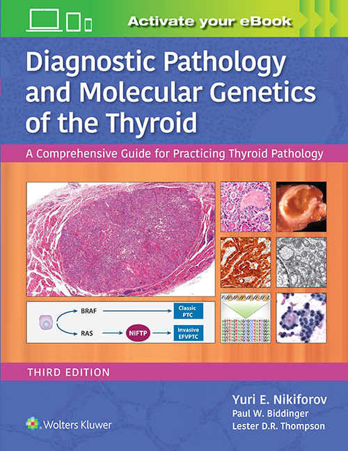 Diagnostic Pathology & Molecular Genetics of theThyroid, 3rd ed.- A Comprehensive Guide for Practicing ThyroidPathology