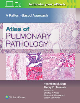 Atlas of Pulmonary Pathology- A Pattern Based Approach