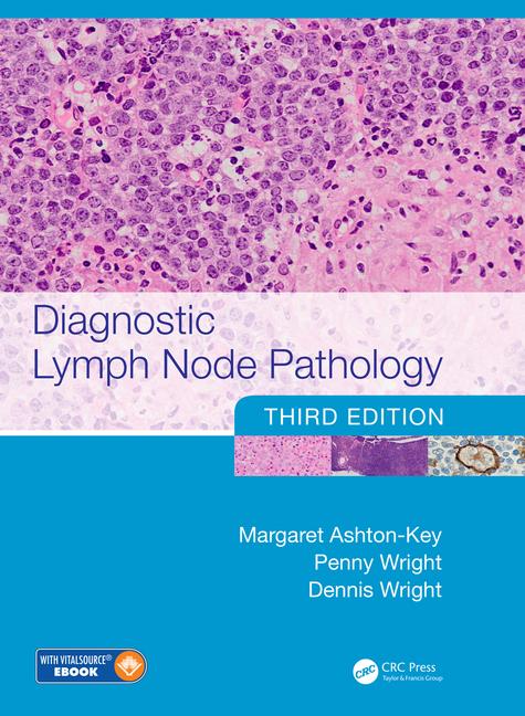 Diagnostic Lymph Node Pathology, 3rd ed.