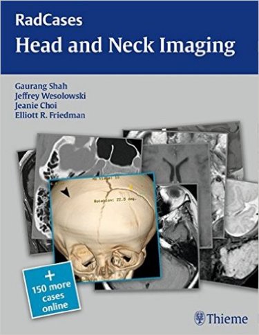 Head & Neck Imaging(Radcases)